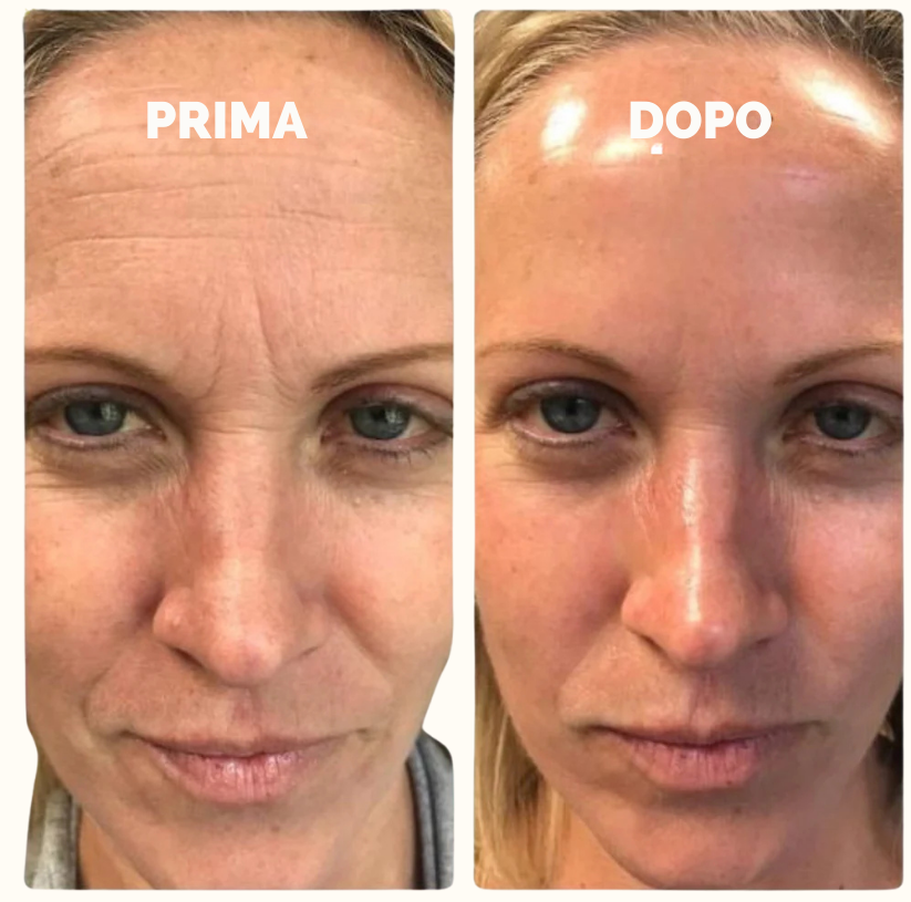 Bellaviva – Maschera Bio-Collagene Esclusiva